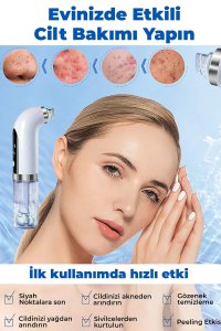 Miland Hydra Vakumlu Cilt Gözenek Siyah Nokta Temizleyici