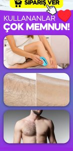 TİTREŞİM ÖNLEYİCİ AYAK 1 PAKET ALAN 1 PAKET HEDİYE (8 ADET),